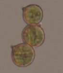 Spores de l'Amanite vaginée ( (Amanita vaginata)