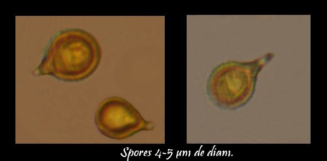 Spores de la Calvatie en outre ( (Calvatia utriformis)