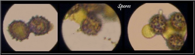 Spores de la Russule sanguine ( (Russula sanguinea)