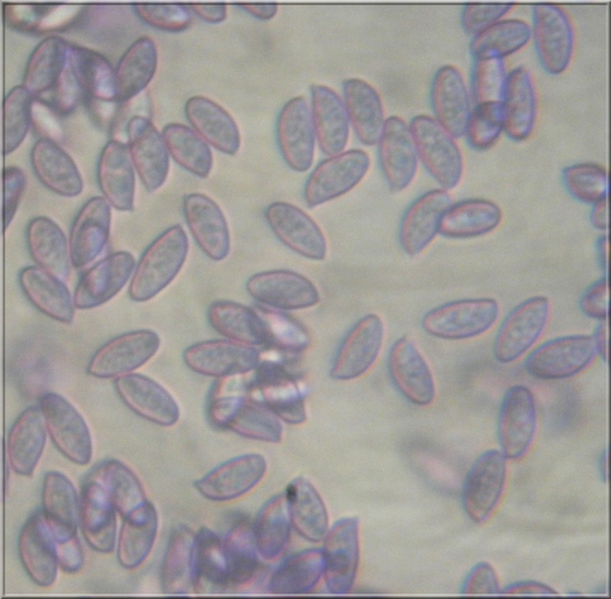 Spores de la Lépiote à base rouge ( (Lepiota ignivolvata)